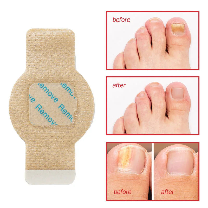 Nail Strengthening Care Patches – Overnight Support for Healthier Looking Nails